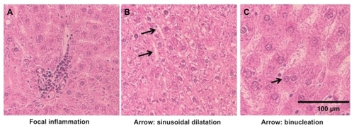 Figure 4 Histopathological alterations with the CeO2 nanoparticle exposure (7.0 mg/kg) include (A) focal inflammation, (B) sinusoidal dilatation, and (C) binucleation of the hepatocyte (400×).