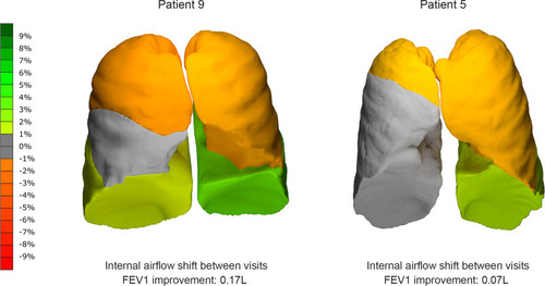 Figure 3 Changes of IAD throughout the experimental period for Subject 9 (left) and Subject 5 (right).