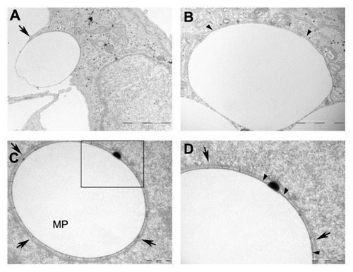 Figure 7 Microparticle localization by transmission electron microscopy. Micrographs of HeLa cells with internalized microparticles. (A) Illustration of the internalization of microparticles; arrow indicates a cell membrane evagination, typical of macropinocytosis. (B) A single membrane surrounding an internalized microparticle. (C) Microparticle surrounded by a double membrane. (D) Enlarged view of the microparticle shown in C.Notes: Arrow heads point to a single membrane tightly associated to microparticle. Arrows indicate the two membrane complex. Scale bars: (A) 2 μm (B) 1 μm (C) and (D) 500 nm.Abbreviation: MP, microparticle.