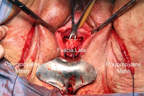 Figure 8 Final aspect of the procedure.