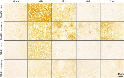Figure 2 Representative images of immunohistochemical staining of GLAST and GLT-1 glutamate transporters in the ischemic core and periphery regions of the cortex. Both GLAST and GLT-1 were activated at 6 h post-ischemia following a distinct decrease from 12 h in the ischemic core region while GLT-1 levels remained increased at 12 h in the ischemic periphery region. Bar scale= 40 µm.
