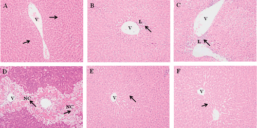 Figure 2.  Effect of different dosage of APAP and MO extracts on the histological changes in the liver tissues. Representative photographs are showing the histological changes in liver tissues. Rats were sacrificed 24 h posttreatment and all tissue sections were stained with hematoxylin and eosin (×200). a) Normal group: normal central vein and hepatic parenchyma; b) APAP-treated group (2 g/kg bw); c) APAP-treated group (4 g/kg bw); d) APAP-treated group (6 g/kg bw); e) MO leaves extract treated group (400 mg/kg bw); f) MO flowers extract treated group (400 mg/kg bw). The arrows indicate normal and necrotic areas. NC, necrotic hepatocyte; L, leucocytes; V, central vein.