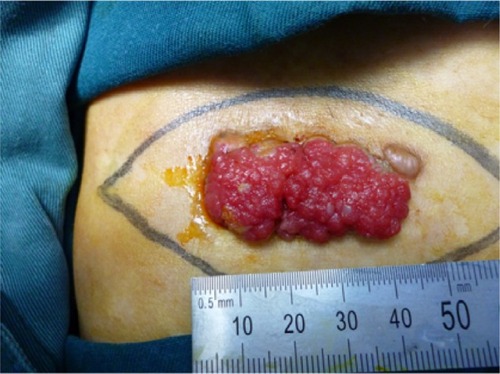 Figure 1 Clinical appearance before surgery.