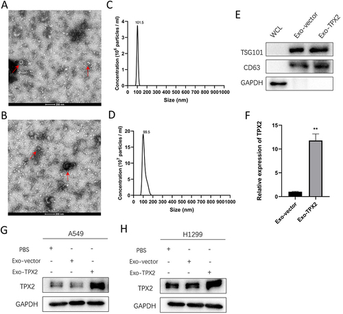 Figure 4 TPX2 can be transferred intercellularly through exosomes. (A and B) Transmission electron microscopy (TEM) images of exosomes isolated from A549 cells (Vector: A, TPX2: (B). Red arrows indicate exosomes. Scale bar: 200 µm. (C and D) The size distribution of exosomes determined from A549 cells (Vector: A, TPX2: (B) by nanoparticle tracking analysis (NTA). (E) Western blot analysis of exosome markers (tsg101 and CD63) in equivalent amounts of protein from A549-derived exosomes and A549 whole cell lysates (WCL) (as a control). (F) The amount of TPX2 mRNA in exosomes isolated from cell supernatant was detected by RT‒qPCR. (G and H) Western blot analysis of TPX2 expression in A549 (G) and H1299 (H) cells after incubation with exosomes. Data were statistically analyzed with paired two-tailed students, t-test. **p<0.01.