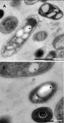 Figure 4 Transmission electron microscopy of DG17 grown on 400 mg/L n-octadecane. Arrows show inclusions of n-octadecane. Reprinted with permission from Hua et al. [Citation31].