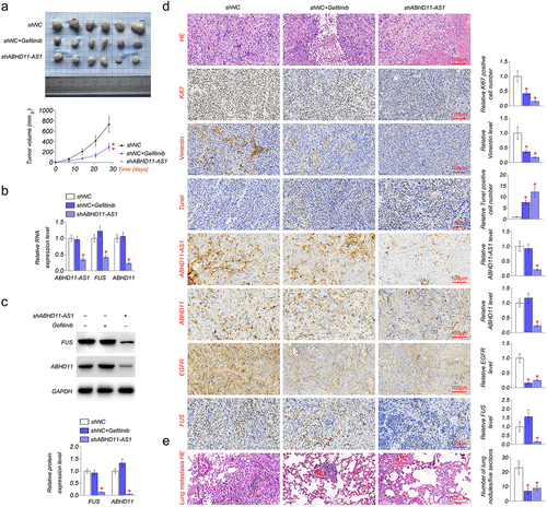 Figure 6. The inhibition of ABHD11-AS1 suppresses tumor growth. (a) the xenografts of SiHa cells were collected in the fifth week. shABHD11-AS1 significantly suppressed the tumor volume as compared to the shNC group. (b) qRT-PCR results revealed ABHD11-AS1, FUS and ABHD11 mRNA expression in tumor tissue by shABHD11-AS1. (c) Western blot was performed to examine the protein levels of FUS and ABHD11 in tumor tissue by shABHD11-AS1. (d) IHC of ki-67, Vimentin, Tunel, ABHD11, EGFR, FUS expression, ISH of ABHD11-AS1 in tumor tissue, HE staining of tumor tissue. (e) The metastasis in lung tissue of nude mice constructed with tail vein injection by HE staining. *p < 0.05 versus shNC.