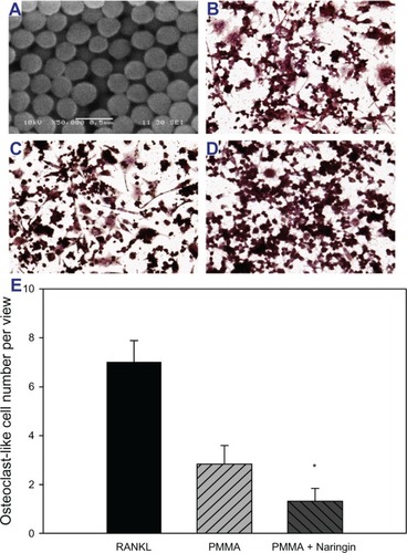 Figure 2 Naringin inhibited polymethylmethacrylate induced osteoclastogenesis of RAW 264.7 cells.