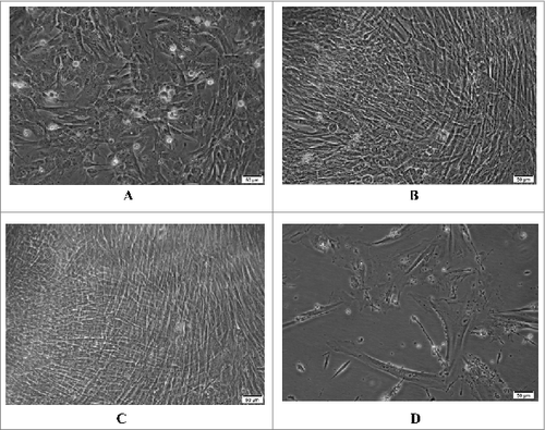 Figure 1. Morphology of the Walvax-2 cells. The cells were cultured and incubated at 37 °C. The photos were taken at 4 h (A), 24 h (B) and 48 h (C) and at 72 h post-subculture for the 58th passage (D).