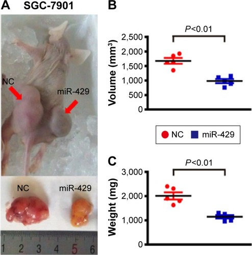 Figure 2 miR-429 reduces gastric cancer (GC) cell growth rate in vivo.Notes: (A) Stable SGC-7901/NC-LV (negative control [NC]) and SGC-7901/miR-429-LV (miR-429) cells were inoculated into left and right flanks of each nude mouse (upper). The mice were euthanized and the tumors were excised (bottom). (B and C) The volume (mm3) and weight (mg) of each group were measured. The average tumor volume and weight were indicated as mean ± standard error. Results are representative of three independent experiments.