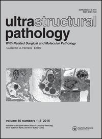 Cover image for Ultrastructural Pathology, Volume 40, Issue 2, 2016