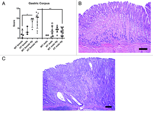 Figure 4. (A) Gastric histologic activity index (GHAI) score of the corpus in the different groups of mice (*, p < 0.05; **, p < 0.01). (B) Mild foveolar hyperplasia in the gastric corpus of a hepatitis C virus transgenic male mouse infected with H. pylori (HT male Hp). (C) Mucosal lesions in the gastric corpus of a hepatitis C virus transgenic female mouse infected with H. pylori (HT female Hp). Lesions consisted of pseudopyloric intestinal metaplasia, epithelial dysplasia, and multifocal inflammation in the mucosa and submucosa. (B and C) bar size 100 µm.