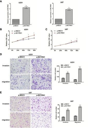 Figure 2 Overexpression of BCYRN1 promotes the proliferation and metastasis of glioma. (A) We used qRT-PCR to measure the expression levels of BCYRN1 in U87 and U251 cells transfected with p-BCYRN1, using p-MSCV as a negative control. The data are presented as the mean±SD (n=3 in each group). **p<0.01 vs the p-MSCV group. (B and C) Overexpression of BCYRN1 significantly increased the proliferative capability of U87 and U251 cells as determined by MTS assays (*p<0.05). (D and E) Transwell assay results for U87 and U251 cells transfected with p-BCYRN1 and p-MSCV. Representative images and the accompanying statistical plots are presented. The data are presented as the mean±SD (n=3 in each group). **p<0.01, ***p<0.001 vs the p-MSCV group.