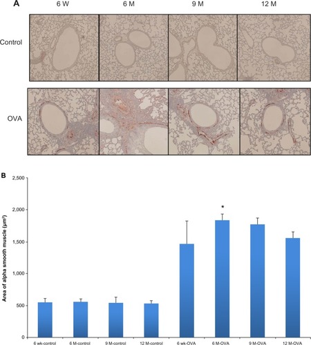 Figure 6 Airway smooth muscle hyperplasia according to age in the acute asthma model. Representative photomicrographs of the area of smooth muscle-stained lung sections (A) (original magnification ×200) and smooth muscle areas of immunostaining per micrometer length of basement membrane of the bronchioles, as assessed using an image analyzer (B).