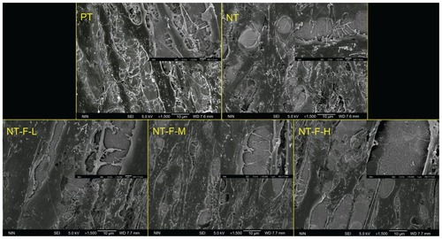 Figure 7 Morphology of HGFs: (A) PT, (B) NT, (C) NT-F-L, (D) NT-F-M, and (E) NT-F-H lacking sufficient prominences/pseudopods and not fusing together.Abbreviations: HGF, human gingival fibroblast; NT, nanotube; PT, polished titanium.