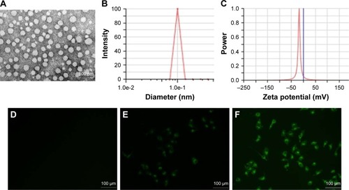 Figure 1 Physicochemical characterization of THA-NPs and fluorescent images of A549 cells treated with different drugs.Notes: (A) TEM image of THA-NPs; (B) THA-NP particle size distribution; (C) zeta potential of THA-NPs; and (D) fluorescent images of A549 cells treated with normal saline for 2 h, (E) treated with a mixture of C6 and MPEG-PCL for 2 h, (F) treated with C6-loaded MPEG-PCL NPs for 2 h.Abbreviations: THA-NPs, nanoparticles loaded with thalidomide; TEM, transmission electron microscopy; C6, Coumarin-6; MPEG-PCL, methoxy poly(ethylene glycol)-poly(ε-caprolactone).