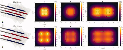 Figure 9. Temperature maps along the major cross-sections A, B, and C (Figure 3 for geometry) after 5 min of heating in an agar phantom for (I) the 10 mm square spacing and (II) the 15 mm square spacing. Isotemperature contours of 41 and 44 °C are visible on all images in green.