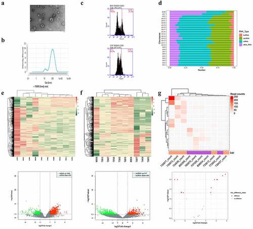 Figure 1. Analysis of differentially expressed exosomal RNAs between patients with gall bladder cancer and those with xantho-granulomatous cholecystitis. A-C. Identification of exosomes isolated from human plasma by transmission electron microscope, nanoparticle tracking analysis, and flow cytometry. D. Bar graph showing the gene distributions of human chromosomes. E-G. Heat maps and volcano plots of DE mRNAs, lncRNAs, and circRNAs