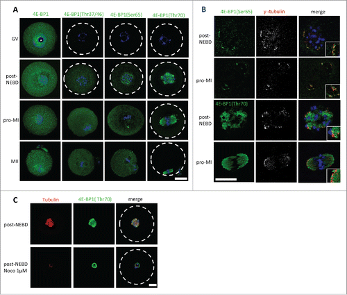 Figure 2. Localization of 4E-BP1 and its phosphorylated forms in the oocytes. (A) Confocal images of different meiotic stages GV (germinal vesicle), post-NEBD (3 h post IBMX wash, PIW), pro-MI (7 h PIW) and MII (12 h) stained with phospho-specific antibody (green) and DAPI (blue), white line indicates oocyte edge. Scale bar = 25 µm. Nucleolus is depicted by asterisk, from at least 3 replicates and n ≥ 30. (B) Marker of the microtubule-organizing centers, gamma tubulin (pseudo-colored and red) co-localizes with 4E-BP1 (Ser65) and (Thr70). Scale bar = 25 µm, n = 10. Enlarged detail in the right bottom corner. (C) Confocal images of control oocytes and oocytes treated with 1 µM Noco for 1 h in the post-NEBD stage (n ≥ 28), tubulin (red), 4E-BP1 (green) and DNA (blue). Scale bar = 20 µm.