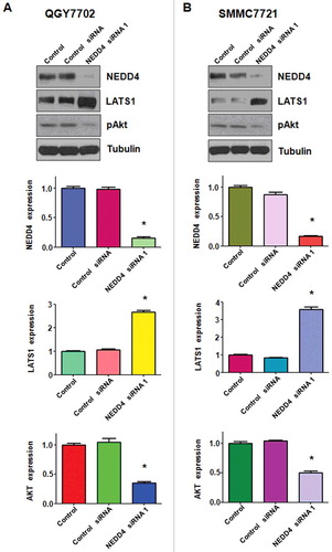 Figure 4. Knockdown of NEDD4 inhibited LATS1 expression. A. Upper panel: Western blotting analysis was used to detect the expression of LATS1 and its target pAkt in QGY7703 liver cancer cell line after NEDD4 depletion. Lower panel: Quantitative results are illustrated for panel A. B. Upper panel: Western blotting analysis was performed to measure the expression of LATS1 and pAkt in SMMC7721 cells after NEDD4 depletion. Lower Panel: Quantitative results are illustrated for panel B. * P<0.05 vs control.