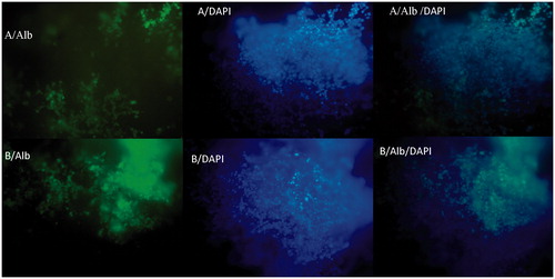Figure 7. The immunocytochemical analysis of differentiated iPSCs on day 20 for Albumin marker on random (A) and aligned (B) nanofibers with nuclear counterstaining (DAPI).