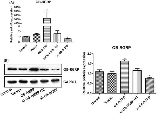 Figure 3. The relative mRNA (A) and protein (B) levels of OB-RGRP in the cells transfected with OB-RGRP siRNA and expression vector which were determined by RT-PCR and western blot, respectively. si-OB-RGRP1: OB-RGRP-siRNA-1; si-OB-RGRP2: OB-RGRP-siRNA-2; si-OB-RGRP3: OB-RGRP-siRNA-3; si-OB-RGRP NC: OB-RGRP-siRNA negative control; Vector: empty expression vector; OB-RGRP: OB-RGRP expression vector. *p < .05 vs. Control.