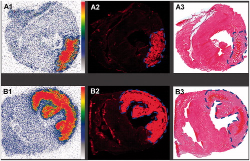 Figure 4. Ex vivo analysis of infarcts and viable heart tissues from rabbits with a small (upper row) and large (lower row) re-perfused acute myocardial infarction (AMI) having received intravenously iodine-123-labeled-hypericin/hypericin (123I-Hyp/Hyp). A1 and B1: autoradiograms of 50-µm thick sections show higher tracer accumulation in infracts than in viable myocardium. The color code bar indicates the coding scheme for the radioactivity. Red color refers areas with the highest 123I-Hyp/Hyp activity, whereas white encodes for the lowest activity. A2 and B2: corresponding low power microscopic images of 50-µm thick sections corroborate the preferential uptake of the highly fluorescent 123I-Hyp/Hyp in AMI contrast to the low fluorescence in viable myocardium. A3 and B3: HE-stained sections confirmed the location of the viable myocardium tissue and the presence of a small (upper row) and large (lower row) lesion of myocardial necrosis characterized by scattered hemorrhage.