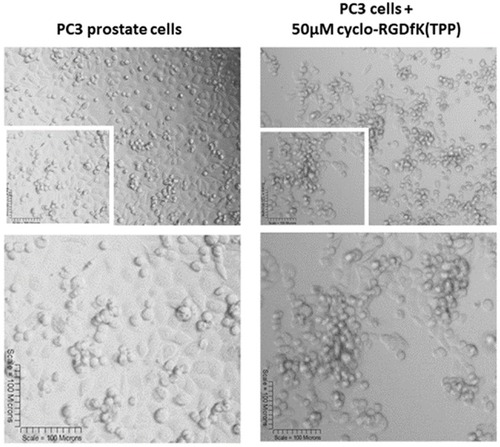 Figure 10 Phase-contrast images of PC3 cell line at 10× objective (top) treated with 50 µM cyclo-RGDfK(TPP) peptide 5 days. 10,000 cells were plated per well in a 96-well plate for 5 days.