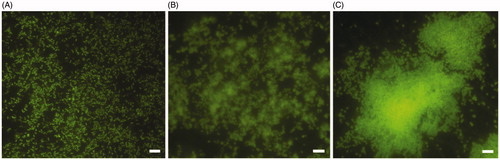 Figure 1. Representative images of fluorescence microscopy of H. pylori NCTC11637 biofilm development over time. The biofilms were stained with Live/Dead kit and visualized after 2 days (A); 6 days (B) and 10 days (C) of incubation. Scale bar =5 μm.