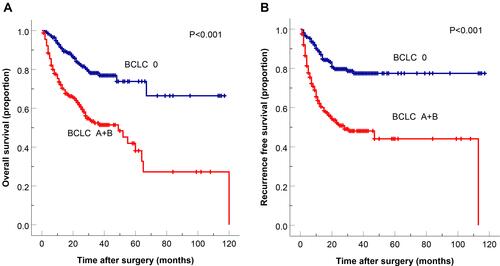 Figure 4 Kaplan–Meier cumulative overall survival (A) and recurrence-free survival (B) curves of patients stratified according to the BCLC stage.