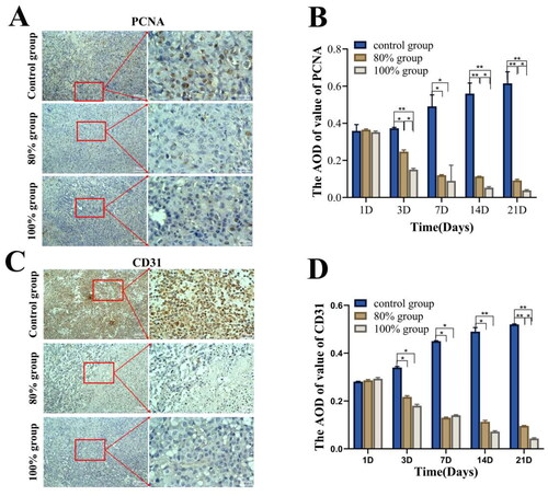 Figure 5. The immunohistochemical analysis of PCNA and CD31 in each group after HIFU ablation in different range. Representative images of PCNA(A) and CD31(C) after 21 day of HIFU ablation in each group. Semi-quantitative analysis of PCNA(B) and CD31(D) positive expression at different time after ablation via AOD value (n = 5, *p < 0.05, **p < 0.001, scale bar = 100 μm).