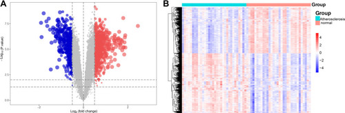 Figure 2 The differentially expressed genes (DEGs) for carotid atherosclerosis and control samples. (A) A volcano plot of the for carotid atherosclerosis and control samples. Red indicated upregulated genes and blue indicated downregulated genes. The gray area showed the gene expression below the threshold criteria. (B) The heatmap of the DEGs.