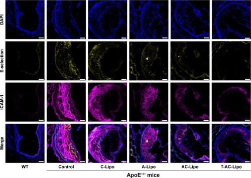 Figure 7 Expression of E-selectin and ICAM-1 proteins in aortic root lesions determined by immunofluorescence analysis.Notes: Yellow and pink fluorescence represent E-selectin and ICAM-1 proteins, respectively. WT, wild-type mouse (C57BL/6) group. Control group, atherosclerotic mouse model (ApoE knockout mouse, ApoE−/−). Scale bars, 100 µm. Liposome concentration, 45 mg/kg body weight. Cur concentration, 2 mg/kg body weight. Ato concentration for A-Lipo and AC-Lipo treatment groups, 1.8 mg/kg body weight. Ato concentration for the T-AC-Lipo treatment group, 1.4 mg/kg body weight.Abbreviations: A-Lipo, atorvastatin calcium-loaded liposome; AC-Lipo, atorvastatin calcium- and curcumin-loaded liposome; Ato, atorvastatin calcium; Cur, curcumin; ICAM-1, intercellular cell adhesion molecule-1; T-AC-Lipo, targeting-ligand-modified atorvastatin calcium- and curcumin-loaded liposome.