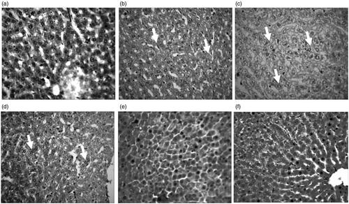 Figure 5. Representative photomicrographs from the liver showing the protective effect of RUT against Cd + EtOH-induced hepatic injury in rats. (a) Control: No visible lession seen (b) Cd: There is mild diffuse degeneration of hepacytes (arrows). (c) Cd + EtOH: There is a severe diffuse hydropic degeneration of hepatocytes (arrows). (d) 25 RUT + Cd + EtOH: Severe central venous congestion and periportal cellular infiltration by mononuclear cells and degeneration of hepatocytes (arrows). (e) 50 RUT + Cd + EtOH: No visible lesion seen (F) 100 RUT + Cd + EtOH: No visible lesion seen. H & E; mag ×400.