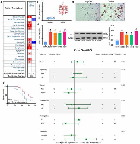 Figure 2. Upregulation of E2F1 in ESCC is correlated with tumor grading and poor prognosis. (a) Detection of E2F1 expression in pan-cancer by Oncomine database (The complete picture is shown in Fig. S1). (b) Detection of E2F1 expression between ESCC and normal tissues by RT-qPCR. (c) Immunohistochemical detection of the distribution of E2F1 in tissues. (d) E2F1 mRNA and protein expression in ESCC cells by RT-qPCR and western blot. (e) The prognosis of E2F1 in ESCC patients was analyzed using Kaplan-Meier analysis. (f) Cox analysis of the correlation between E2F1 and pathological characteristics of ESCC patients. The data were recorded as means ± SD. Paired t-test was utilized for two-group comparison (panel B), and one-way ANOVA followed by Tukey’s post hoc test was applied to compare differences when the number of groups was greater than two (panel D). *p < 0.05