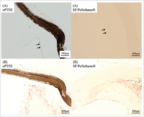 FIGURE 5. (A) Both patches were stained by CD31, and the stained region was only inside of the patch. The endothelial cells appeared along the vessel-like layer under the patch. (B) Also, the smooth muscle layer was formed along a native vessel and arranged clearly such as an arterial media.