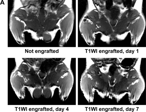 Figure 6 (A) T1WIs of rats before MNP-Mn(II)-labeled BMSCs were injected into the right hip. T1WIs of rats after MNP-Mn(II)-labeled BMSCs were injected into the right hip on days 1, 4, 7, 14, 21, and 28. Hyperintense T1 signals in the right hip represented the presence of engrafted MNP-Mn(II)-labeled BMSCs in vivo. (B) The relative signal intensity of the MNP-Mn(II)-labeled BMSC injection region and the adjacent soft tissue over time. (C) The area of time-dependent hyperintense signals generated by MNP-Mn(II)-labeled BMSCs.Abbreviations: BMSCs, bone marrow-derived stem cells; MNP-Mn(II), manganese (II) ions chelated to melanin nanoparticles; MRI, magnetic resonance imaging; PBS, phosphate-buffered saline; WI, weighted image.