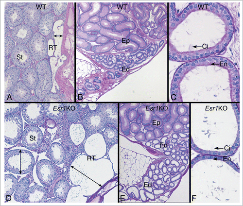 Figure 5. Testis and efferent ductules in the wild type (WT) and Esr1KO mice. (A) WT testis showing the narrow width of the rete testis and normal seminiferous tubules (St). (B) WT head of the epididymis region showing the coiled common efferent ductule (Ed) adjacent to the initial segment epididymis (Ep). (C) WT proximal region of the efferent ductules have a wider lumen than the common duct and show a PAS+ endocytic and brush border of microvilli (En) on the nonciliated cells and long cilia (Ci) protruding in the lumen from the ciliated cells. (D) Esr1KO testis showing dilated rete testis (RT) filled with fluid and causing dilation of seminiferous tubules (St). (E) Head of the epididymis region in the Esr1KO showing dilated efferent ductules (Ed) adjacent to the initial segment epididymis (Ep). (F) Esr1KO showing the dilated proximal region of the efferent ductules. The epithelium is shorter in height and appears to have lost PAS+ endocytic and brush border lining (En) on the nonciliated cells. Cilia (Ci) are noted but they appear to be thinner in density.