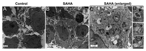 Figure 3. SAHA induced autophagosome formation. Representative ultra-structures using transmission electron micrographs of GSCs treated with either DMSO (control, < 0.1%) or 5 μM SAHA for 48 h. (A) Nuclear and mitochondrial morphologies are normal in control cells (original magnification, ×6000). Control cells also contained a richly granular cytoplasm, relatively more mitochondria. (B) SAHA treatment of GSCs for 48 h resulted in the development of autophagic vacuoles (original magnification, ×6000). The cells exhibited a sparsely granular cytoplasm, few mitochondria, and vacuoles containing membranous and partially degraded granular cytoplasm indicative of autophagic activity. (C) Amplification (original magnification, ×20000) from the square region of (B). Arrowheads denote representative autophagic vacuoles that contain remnant of organelles. N, nucleus; M, mitochondria; L, lysosome. (D–F) are pictures with higher magnification showing detailed autophagosome structure. Some of these vacuoles contained remnants of organelles, including mitochondria (D), (E: arrows) and endoplasmic reticulum (F: arrowhead). The cells with autophagic vacuoles were defined as cells that had five or more autophagic vacuoles. For these treatments, TEM images were randomly chosen, from a field of at least 100 cells. Scale bars: 2 μm; 1 μm (indicated enlargements).