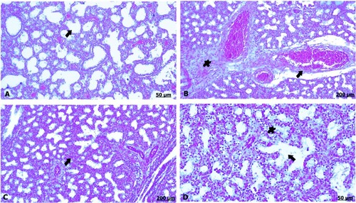 Figure 5. (A–D) Light photomicrograph of sections from foetal lung of control (A) and GAE received group (B–D) stained with H & E.: light photomicrograph of (A) shows intact alveoli and vasculature. Photomicrograph of (B) shows remarkable degree of dilatation and congestion of the blood vessels. Photomicrograph of (C) shows thickening of the interalveolar septa shows severe thickening and congestion of the blood vessels. Photomicrograph of (D) shows erythrocytes infiltration (star), moreover, alveolar emphysema (arrow).