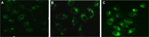 Figure 4 MDC-labeled autophagic vacuoles in PC-2 cells by fluorescence microscope after RPM treatment. Autophagic vacuoles were labeled with 0.05 mmol/L MDC in PBS, at 37°C for 10 minutes. (A) 0 nmol/L RPM group; (B) 10 nmol/L RPM group; and (C) 15 nmol/L RPM group (×200).