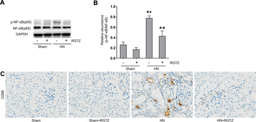 Figure 6 RGTZ mediates NF-κB pathway activation and inhibits macrophage infiltration in the kidneys of HN rats. (A) Kidney tissue lysates were subjected to immunoblot analysis with specific antibodies against p-NF-κB (p65), NF-κB (p65), or glyceraldehyde 3-phosphate dehydrogenase (GAPDH). (B) Expression levels of p-NF- κB (p65) were quantified by densitometry and normalized to NF-κB (p65). (C) Photomicrographs (original magnification, ×400) illustrate immunohistochemical staining for CD68 in kidney tissue. RGTZ, rosiglitazone. Data are represented as the mean ± SEM. *p < 0.05 vs sham group; #p < 0.05 vs sham + RGTZ group. **p < 0.05vs. HN group.