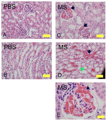 Figure 1 Morphine treatment exacerbates renal pathology in NY1DD mice. H&E stained kidney sections of NY1DD mice treated with morphine for 3 weeks. Cortical and cortico-medullary regions with glomerular and tubular histology are shown. Glomerular and tubular morphology in PBS-treated mouse kidneys (A and B). Note the severe intraglomerular congestion (C and E, black arrows), tubular dilatation and loss of brush border (D, green arrow), and peritubular congestion (black arrow) in morphine-treated mice.