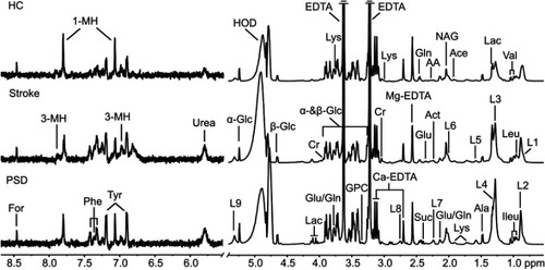 Figures S2 Representative plasma 600 MHz one-dimensional Carr-Purcell- Meiboom-Gill (1D-CPMG) 1 H NMR spectra obtained from a PSD subject, a stroke subject, and a healthy control subject. The spectrum resonances assigned to the metabolites including 1-methylhistidine, 3-hydroxybutyrate, 3-methylhistidine, acetoacetate, acetate, acetone, alanine, creatine, formate, glucose, glutamine, glutamate, glycerolphosphocholine, isoleucine, LDL CH 3 -(CH 2)n -, VLDL CH 3 -(CH 2)n -, lipid - CH2 -CH=CH-, lipid -CH2 -C=O, lipid, -CH=CH-, lactate, leucine, lysine, N-acetyl glycoprotein, phenylalanine, succinate, tyrosine, and valine are noted.