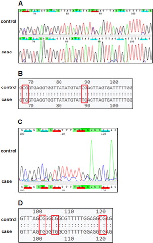 Figure 2. Pairwise comparison of target CpG islands between factor XIII deficient patients without ICH (control) and those with ICH (case). (A) Representative chromatogram from Sanger sequencing of the MMP-2 gene. Tags indicate CG and TG dinucleotides. (B) Plain text format from Sanger sequencing of the MMP-2 gene. Boxes indicate CG and TG dinucleotides. (C) Representative chromatogram from Sanger sequencing of the MMP-9 gene. (D) Plain text format from Sanger sequencing of the MMP-9 gene.