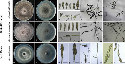 Fig. 2 (Colour online) Morphological characteristics of species of Alternaria isolated from ginseng. a, g, m, Colony morphology on PDA incubated for 7 days at 25°C. b, h, n, Colony morphology on PCA incubated for 7 days at 25°C. c, i, o–p conidia; d, j, q–r conidiophores; e, f, k, l, s, t conidia chains. a–f, Alternaria alternata. g–l, A. tenuissima. m–t, A. panax. Scale bars: 20 μm