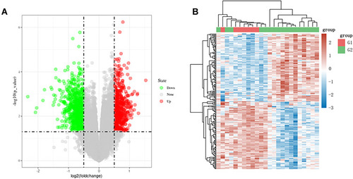 Figure 2 Results of GEO data mining. (A) Heat map of differential gene expression; (B) volcano map of differential gene expression.