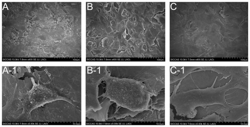 Figure 5 SEM images of different surfaces after exposure to osteoblast cell suspension (4 × 104 cells/cm2) for 1 day: (A) untreated Ti surface; (B) NT surface; (C) Ag-NT surface; under higher magnification, (A-1 and B-1), and (C-1) show the morphology of adhered osteoblasts on Ti, NT, and Ag-NT, respectively.Abbreviation: SEM, scanning electron microscopy.