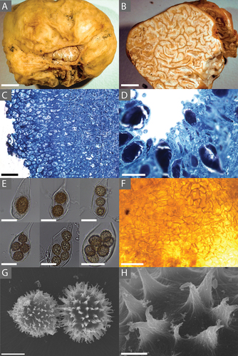 Figure 2. A. Tuber rugosum (BR64, holotype) ascocarp showing both the rugose peridium and exposed sterile gleba. B. A cross-section of T. rugosum (BR64) showing the gleba and its marbling. C. A cross-section (stained with toluidine blue O) of T. rugosum (RH999) showing the distinctive long, narrow cells of the immature peridium. D. Hymenium (stained with toluidine blue O) of an immature specimen showing the developing asci and paraphyses. E. Ascii of T. rugosum (BR64) containing 1, 2, 3, 4, 5, and 7 ascospores. F. Mantle of T. rugosum (GenBank MW579340) on the root tip of a red oak (Quercus rubra). G. SEM image of a T. rugosum ascospore (BR64) showing the echinate surface. H. SEM image showing details of the uncinulate spines on the ascospore of T. rugosum (BR64, holotype; GenBank MW579336). Bars: A, B = 6.0 mm; C, F = 50.0 μm; D = 25.0 μm; E = 30.0 μm; G = 10.0 μm; H = 2.0 μm.