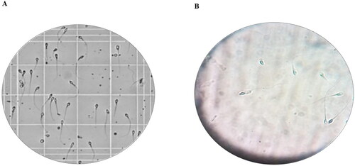 Figure 6. Light microscope photomicrographs showing sperm cells A) before addition of PNL-INV gel B) after addition of PNL-INV gel.PNL: Propranolol Hydrochloride, INV: Invasome.