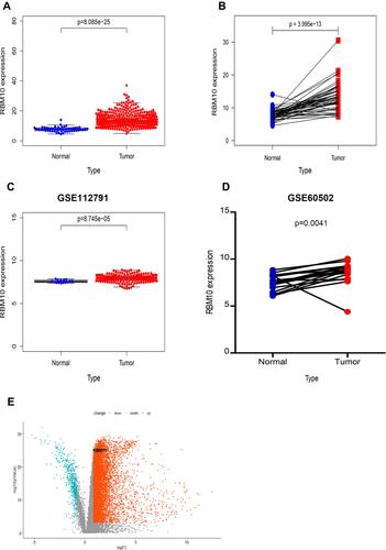 Figure 2 Transcriptional characteristics of RBM10 in HCC samples. (A) Differences in RBM10 transcription between HCC and normal liver tissues (data originated from the TCGA, ntumor=374, ±S 14.38±4.70; nnormal=50, ±S 7.77±1.58; p < 0.001); (B) Differences in RBM10 transcription between 50 paired HCC-normal tissues (data obtained from the TCGA, npair=50, Tumor ±S 13.40±4.22; Normal ±S 7.77±1.58; p < 0.001); (C) RBM10 transcription in HCC patients from the GEO datasets (GSE112791, ntumor=183 ±S 7.94±0.42; nnormal=15, ±S 7.58±0.16; p < 0.001); (D) RBM10 transcription in 18 paired HCC and normal liver tissues from the GEO datasets (GSE60502, npair=18, Tumor ±S 8.59±1.22; Normal ±S 7.49±0.83; p = 0.0041); (E) Volcano plot based on DEGs between HCC and normal liver tissues (data originated from the TCGA).